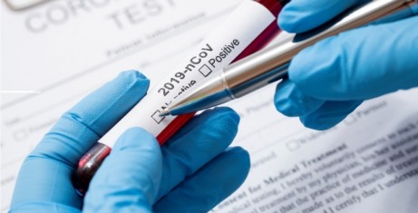 Prefeitura contrata laboratório particular para realização de testes