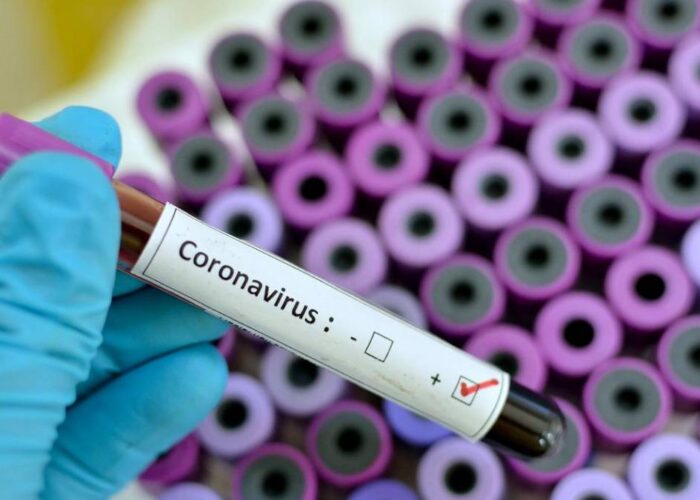 Segundo o jornal Diário de Uberlândia, cidade ultrapassa 4 mil casos confirmados de coronavírus
