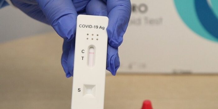 Minas Gerais distribui mais de 1 milhão de testes rápidos de covid-19