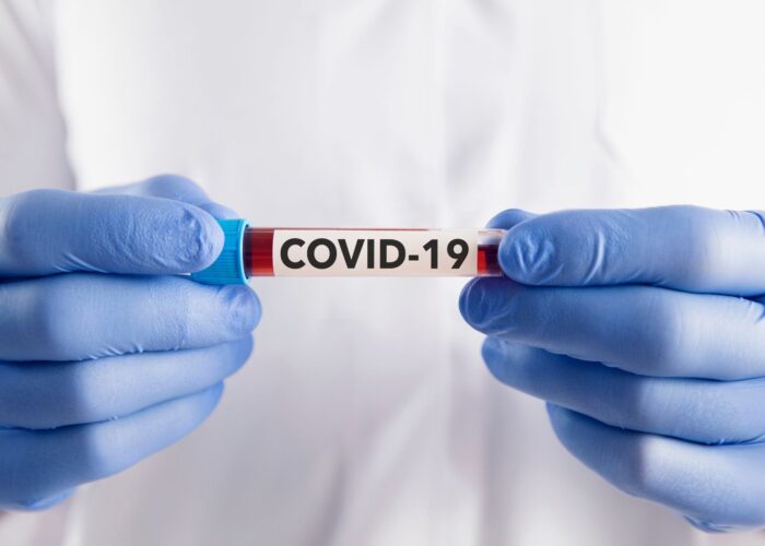 Ituiutaba registra 585 novos casos de Covid-19 e 2 mortes