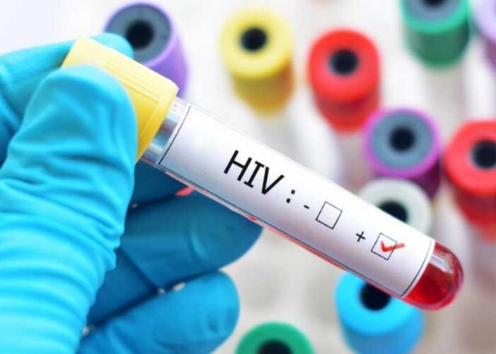 Mais de um milhão de pessoas vivem com HIV no Brasil