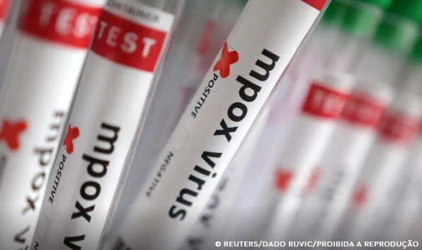 Sobe para 140 número de casos confirmados de Mpox no país, em 2026